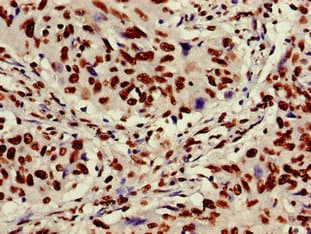 XRCC6 / Ku70 Antibody