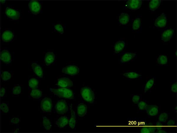 IHC-plus™ SP1 Antibody (clone 1A5)