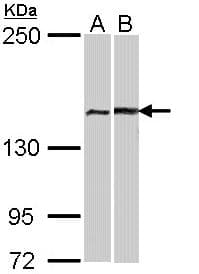 IHC-plus™ FANCA Antibody (N-Terminal)