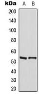 MEF2A / MEF2 Antibody (phospho-Thr319)
