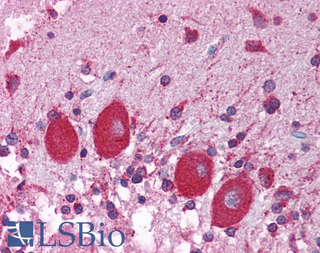 Polyclonal Rabbit anti-Human NUCB1 / Nucleobindin Antibody (C-Terminus, IHC, WB)