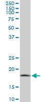Monoclonal Mouse anti-Human ARF5 Antibody (clone 1B4, IF, WB)