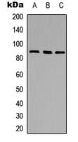 Polyclonal Rabbit anti-Human DPP4 / CD26 Antibody (C-Terminus, WB)