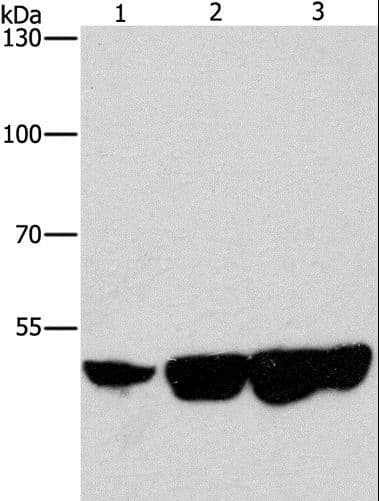 Polyclonal Rabbit anti-Human CTBP2 Antibody (IHC, WB)