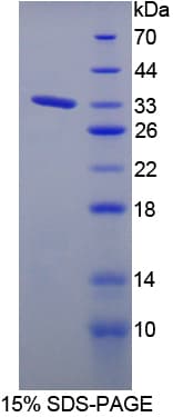 Rat PTPRJ / CD148 Protein (Recombinant His-T7)