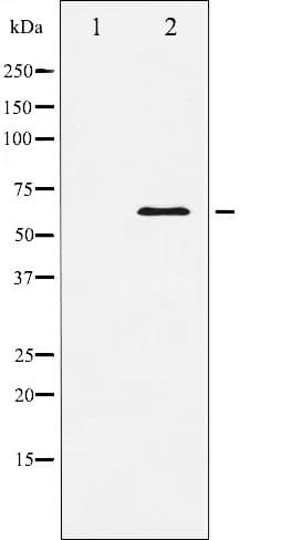 Polyclonal Rabbit anti-Human DOK1 Antibody (IHC, IF, WB)
