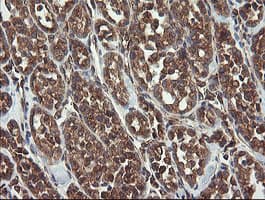 UBE2J1 Antibody (clone OTI1C7)