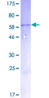 Human MYD88 Protein (Recombinant GST)