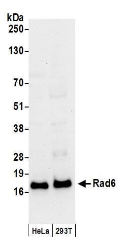 Polyclonal Rabbit anti-Human UBE2A Antibody (N-Terminus, IHC, WB)