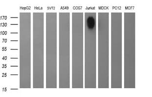 Monoclonal Mouse anti-Human CD45 / LCA Antibody (clone OTI2E7, IHC, IF, WB)