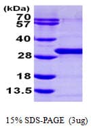 Human RAB21 Protein (Recombinant His)