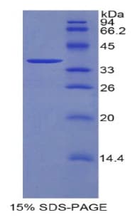 Mouse DKK4 Protein (Recombinant His-GST)