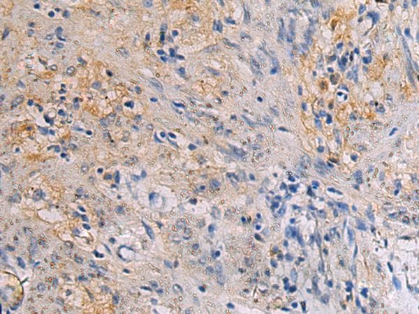Polyclonal Rabbit anti-Human CHST3 Antibody (IHC)