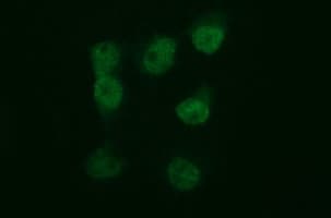 TUBB2B / Tubulin Beta 2B Antibody (clone OTI5D3)