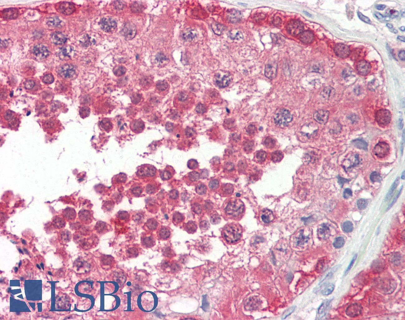 IHC-plus™ PPP2R4 Antibody (aa347-358)