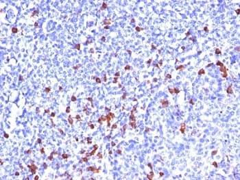 Monoclonal Mouse Anti-Human Kappa Light Chain Secondary Antibody (clone SPM508, IHC, IF, WB)