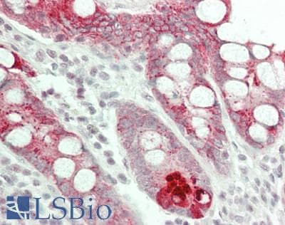 IHC-plus™ ATXN1 / SCA1 Antibody (C-Terminus)