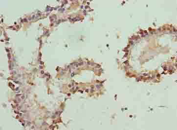 PLP1 / Myelin PLP Antibody (aa143-197)