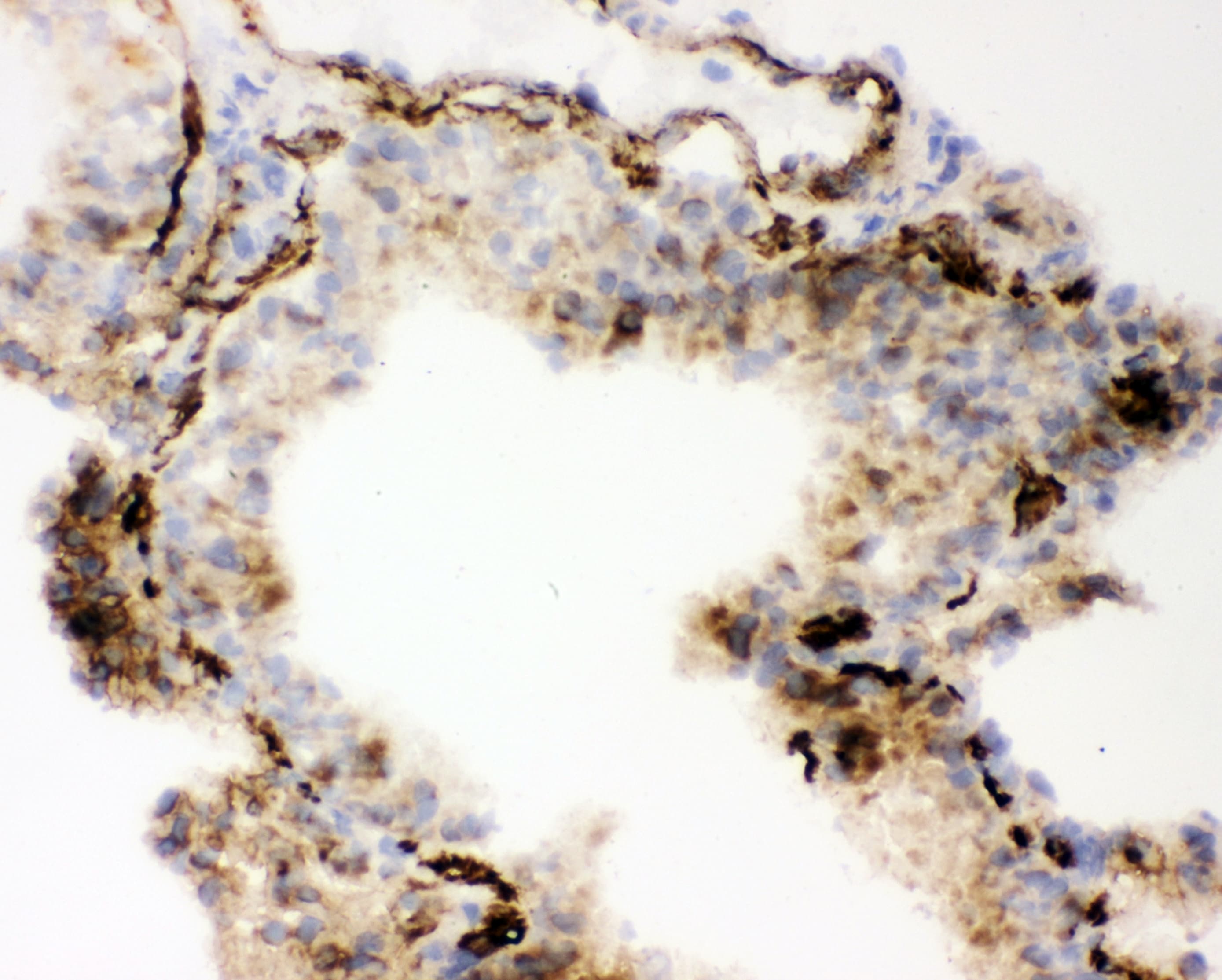 ACE / CD143 Antibody (aa651-864)