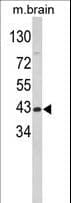 Aspartate Aminotransferase Antibody (aa5-33)
