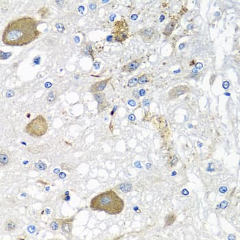 IL28B Antibody