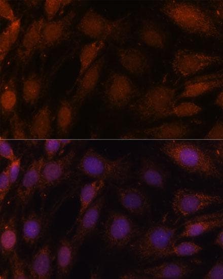 Polyclonal Rabbit anti-Human GCAT Antibody (IHC, IF, WB)