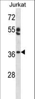 Polyclonal Rabbit anti-Human OVOL1 Antibody (aa1-29, WB)