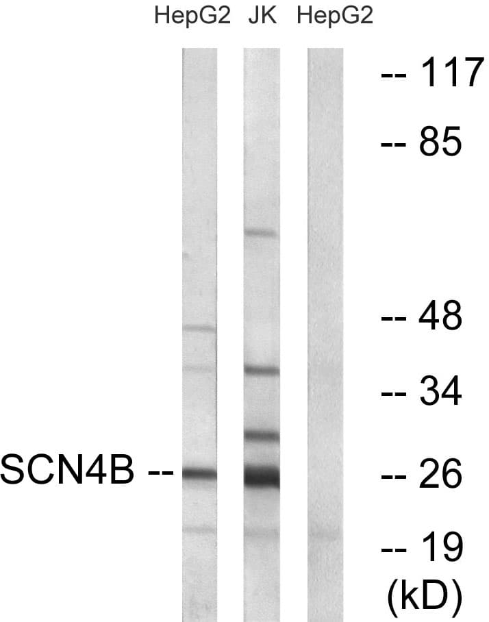 IHC-plus™ SCN4B Antibody (aa61-110)
