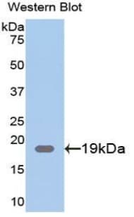 CLIC4 Antibody (aa104-253)