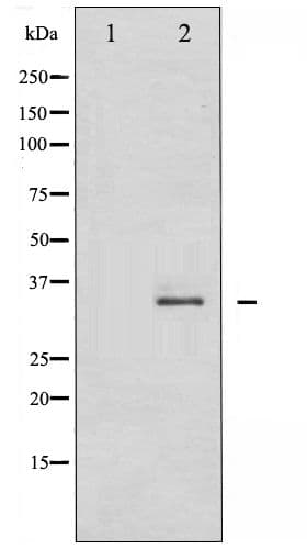 CDK2 Antibody (phospho-Thr160)