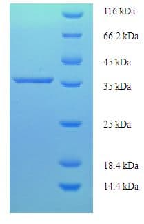 Human PDLIM3 Protein (Recombinant His-SUMO)