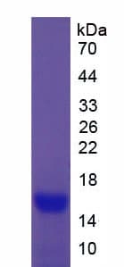 Mouse CEA / Carcinoembryonic Antigen Protein (Recombinant His)