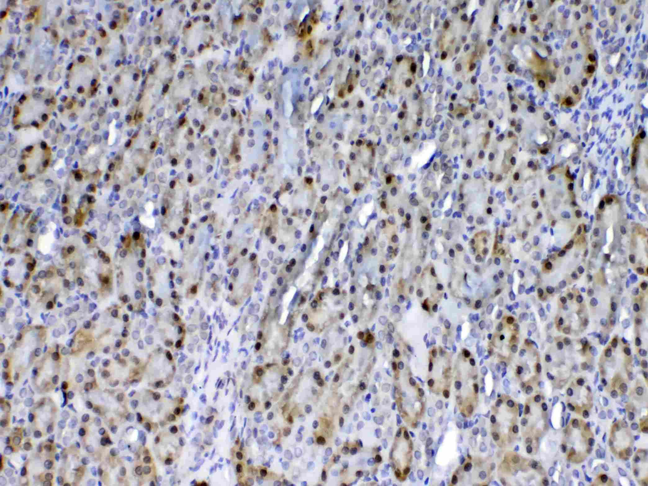 GSTP1 / GST Pi Antibody