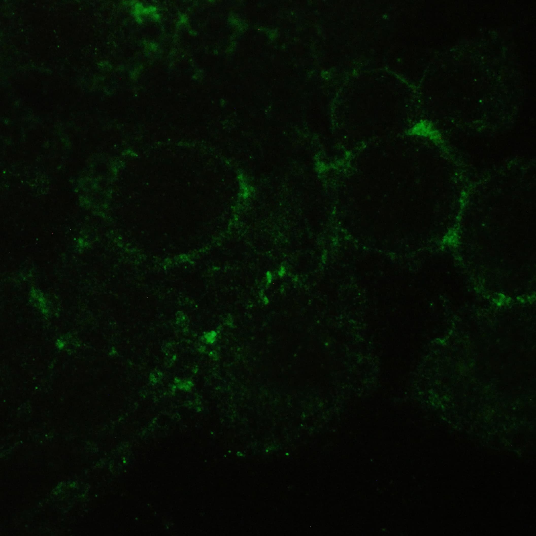 Basigin / Emmprin / CD147 Antibody