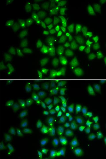 Polyclonal Rabbit anti-Human PCGF6 Antibody (IF, WB)