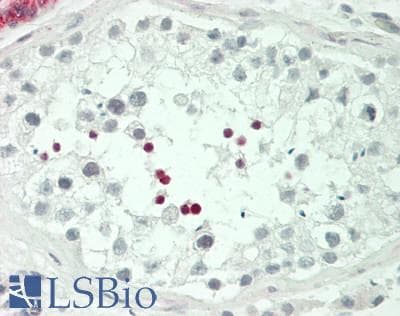 IHC-plus™ Polyclonal Rabbit anti-Human CREM / ICER Antibody (Internal, IHC, WB)