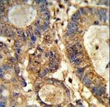 GUSB / Beta Glucuronidase Antibody (aa335-362)