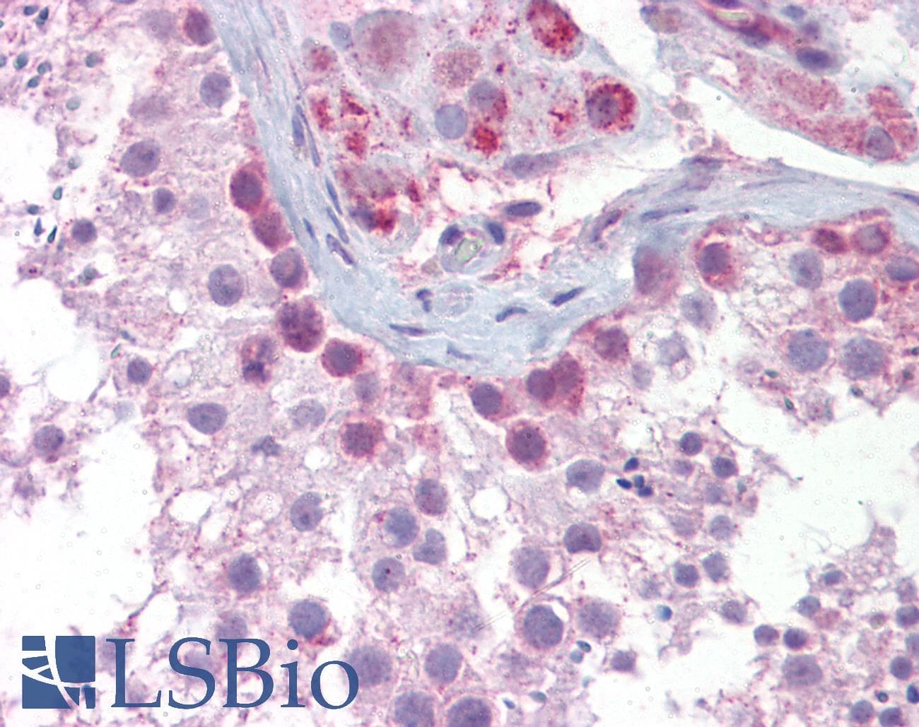 SYCP3 / SCP3 Antibody (N-Terminus)