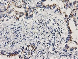 PNMT Antibody (clone OTI2D5)