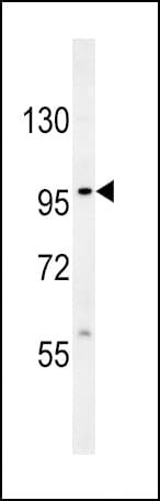 Polyclonal Rabbit anti-Human VLDLR Antibody (aa484-510, IHC, WB)