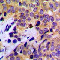 PathPlus™ Polyclonal Rabbit anti-Human KRT8 / CK8 / Cytokeratin 8 Antibody (C-Terminus, IHC, IF, WB)