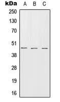 IHC-plus™ SERPINB7 / MEGSIN Antibody (Internal)