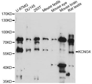 KV6.4 / KCNG4 Antibody