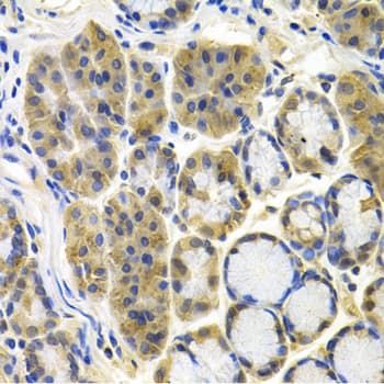 APBB1 / FE65 Antibody