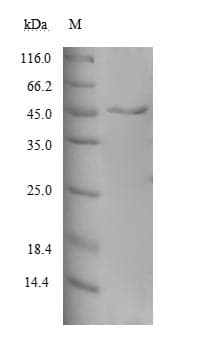 Human MAGOH Protein (Recombinant GST, N-terminus)