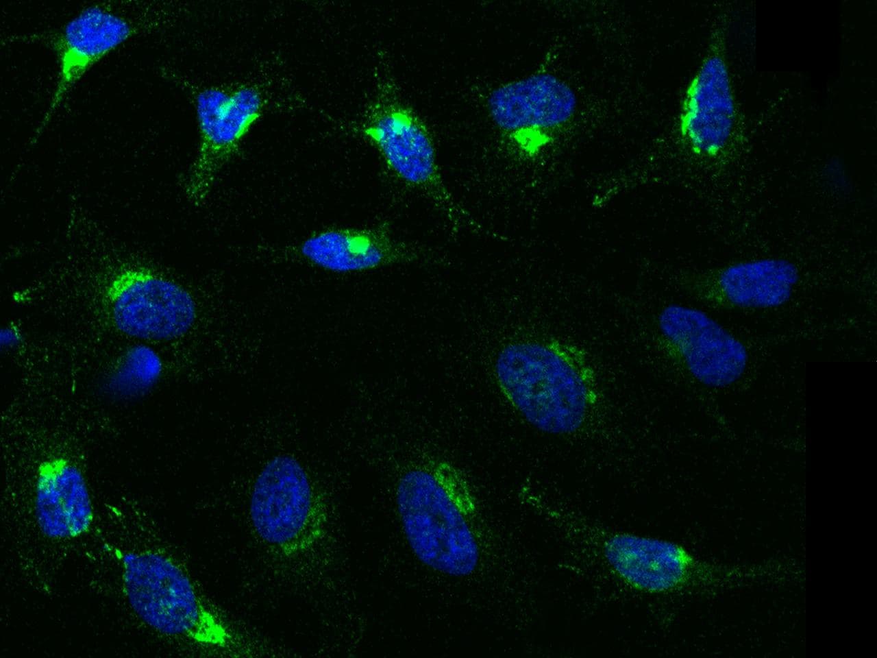CLU / Clusterin Antibody (Preservative Free)