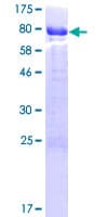Human CABS1 Protein (Recombinant GST)