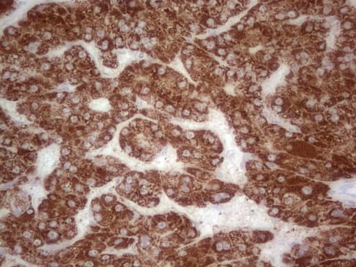 ABAT Antibody (aa29-323, clone OTI7H1)