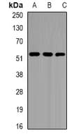 PathPlus™ Polyclonal Rabbit anti-Human EPHX1 / Epoxide Hydrolase 1 Antibody (IHC, WB)