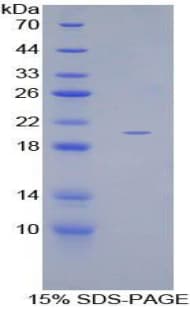 Human GDF10 / BMP3B Protein (Recombinant His-T7)